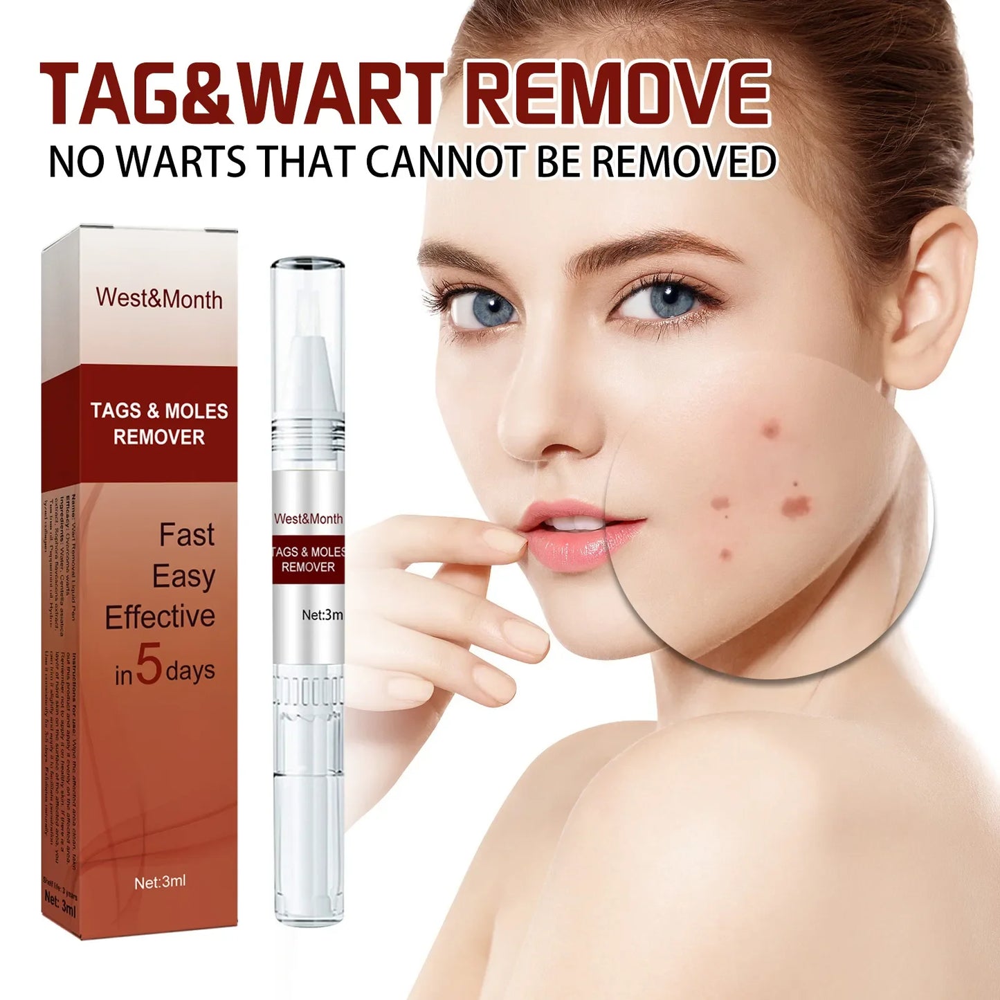 skin tag remover pen liquid wart remover